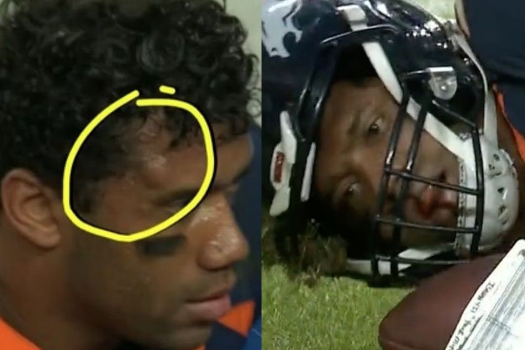 What Happened to Russell Wilson