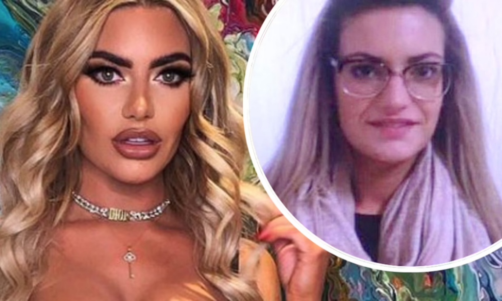 Megan Barton Hanson before and after plastic surgery