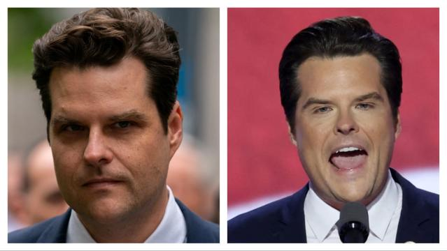 Matt Gaetz Botox